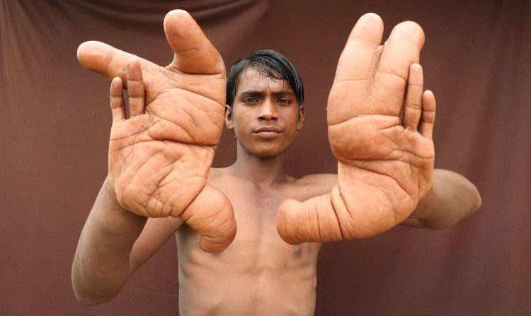 Tarik's gigantic hands.