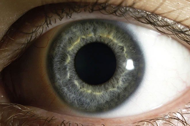Pupil size is the diameter of the black circular hole at the center of the eye.