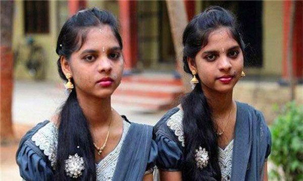 Two girls born alike despite not being related.