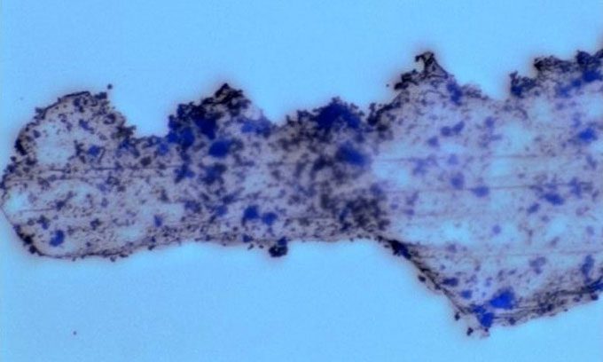Tiny catalytic robot (dark blue dot) covering microplastics.