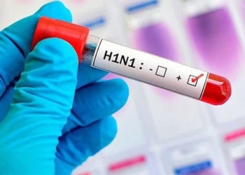 virus cum h1n1 650