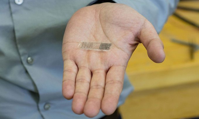 The electrical stimulation device for fractures (FED) is biodegradable in the body.