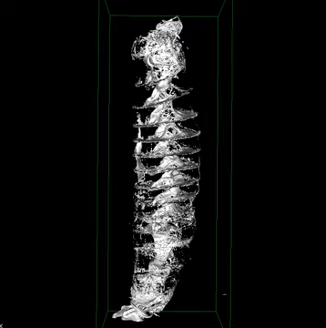 3D model of a shark's intestines.