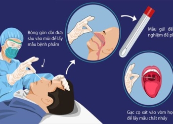 cach lay mau test nhanh covid tai nha 650
