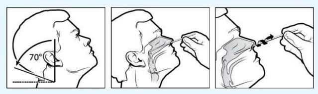 Procedure for collecting oropharyngeal samples.