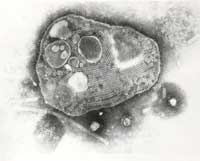 7 RinderpestVirus