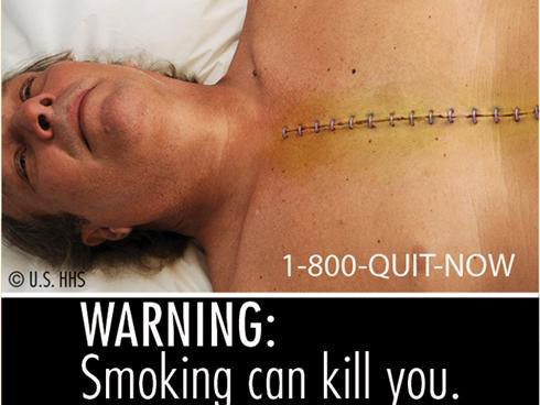 One of the warning images about the dangers of tobacco