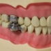 DentalSlim Diet Control 650
