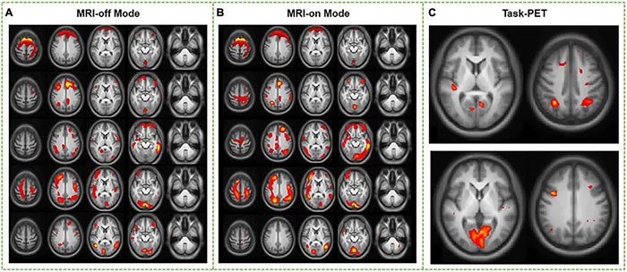 Experts conducted fMRI to measure brain activity in individuals.