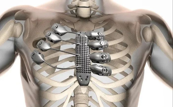 Bones consist of tubular and hollow structures.