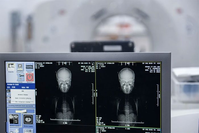 After the measurements, the technician goes to the control room to perform a CT simulation for the patient.