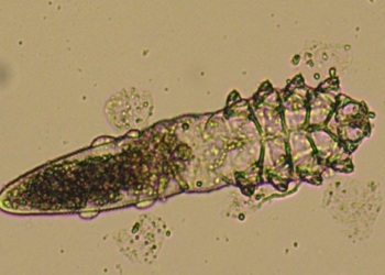 demodex parasitic mite species on human skin 62809