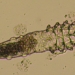 demodex parasitic mite species on human skin 62809