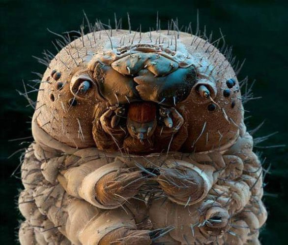 "Portrait" of Demodex mites living on the human face