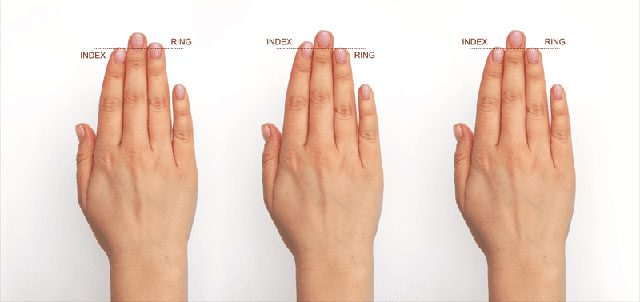 The longer the ring finger, the higher the trend of alcohol tolerance.