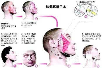 experience grafting eye trees from china 2019