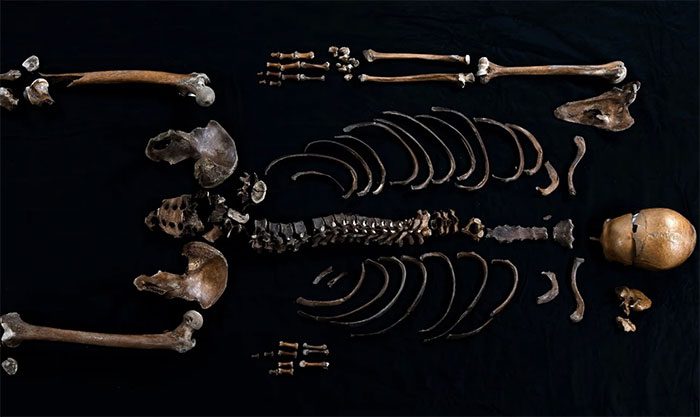  Remains of the "man in the well," believed to be a character from the Sverris Saga in Norway. 