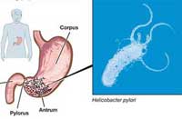 helicobacter