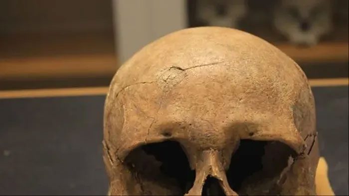 A Viking skull showing signs of blunt force trauma to the forehead.