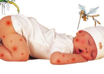 how to identify children with hemorrhagic fever 55002