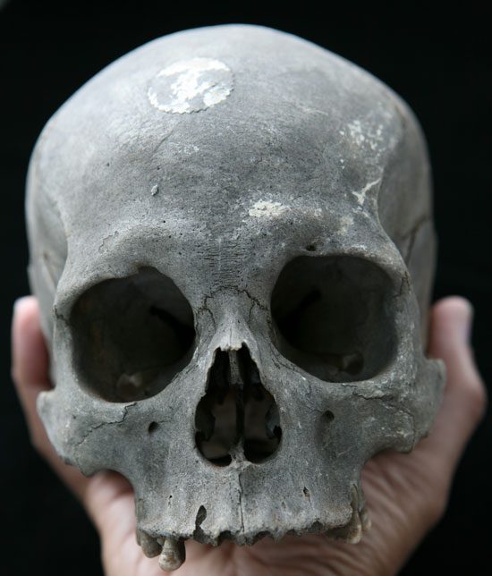 Human skull