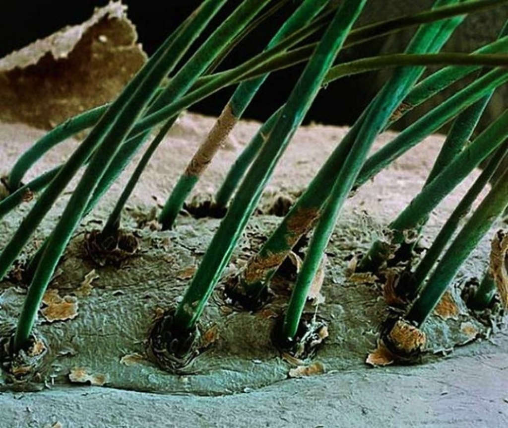 Human eyelashes magnified 50 times