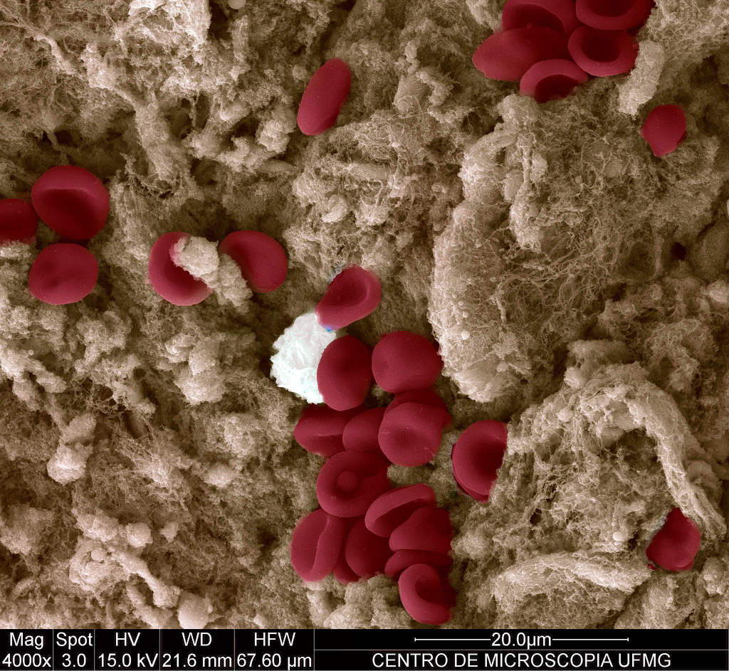 Blood cells on a cut