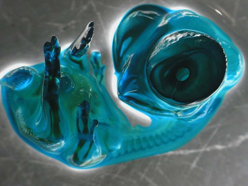 A chicken embryo under a microscope