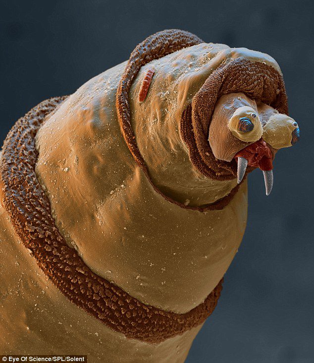 A parasite under a microscope