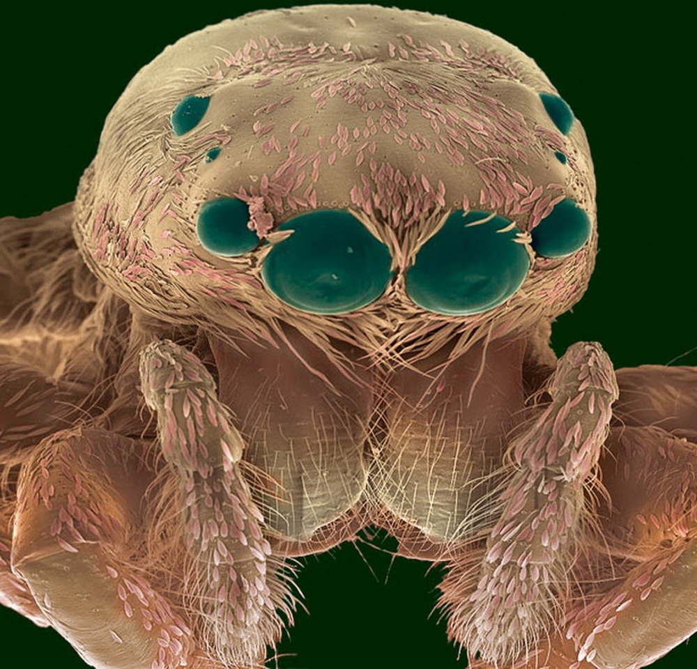 A Spider Under the Microscope