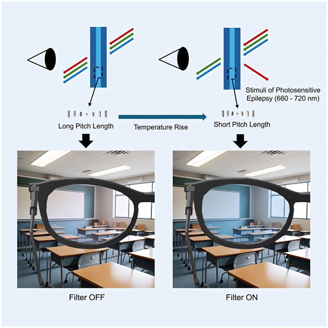 Special glasses help prevent seizures with the ability to block up to 98% of light