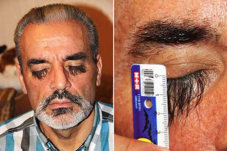 Mr. Valery's eyelashes measure 3 cm.