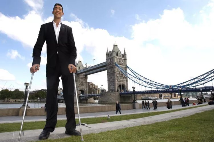 A man named Kosen from Turkey turns heads whenever he walks down the street.