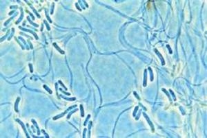 microorganisms overcome the release step when absorbing oxygen and carbonic acid in photosynthesis process 19651