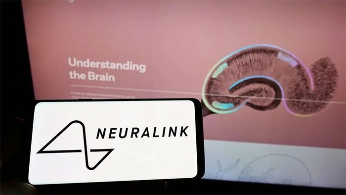 Elon Musk's Neuralink approved for human brain chip trials.