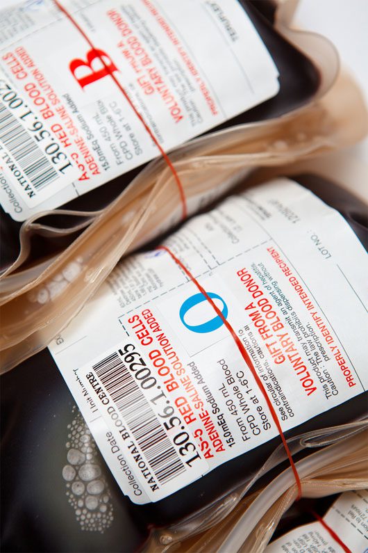 Blood type O is the most common blood type.