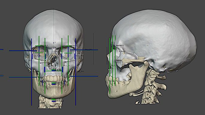 Reconstruction process of the young girl in Mladeč cave