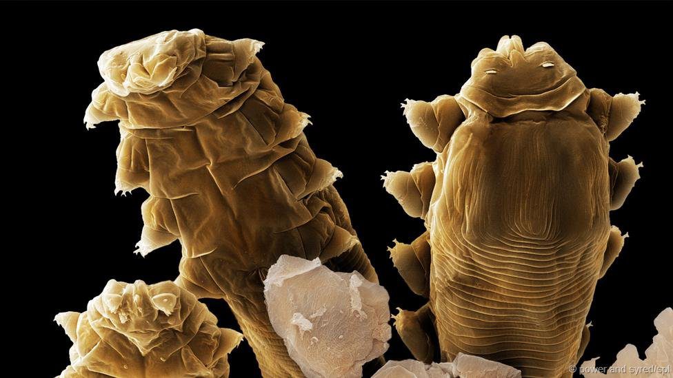 Demodex - The Mite that Parasites on... Human Skin