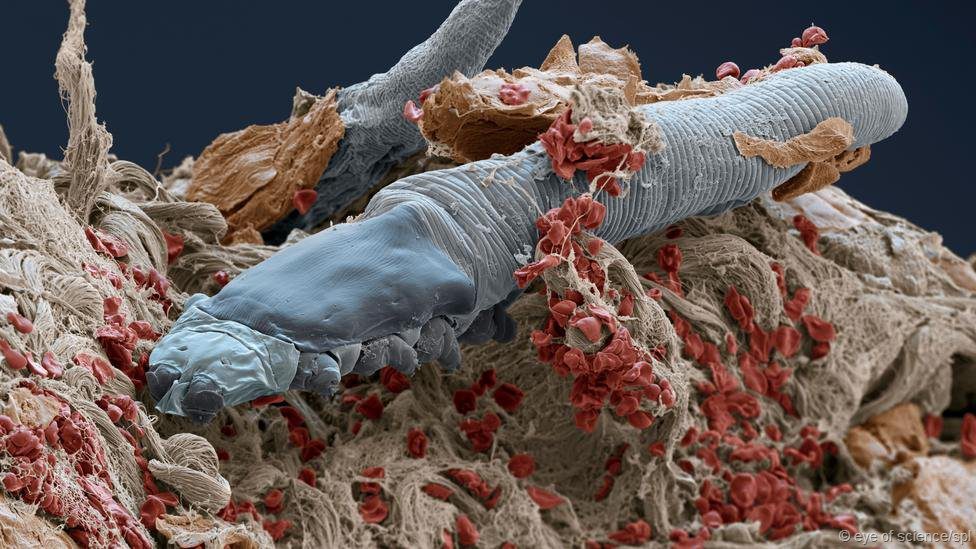 Demodex - The mite that parasitizes on... human facial skin