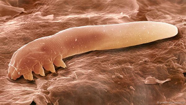 Demodex - The Mite that Parasites on... Human Skin