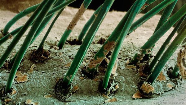 Demodex - The Mite that Parasites on... Human Skin