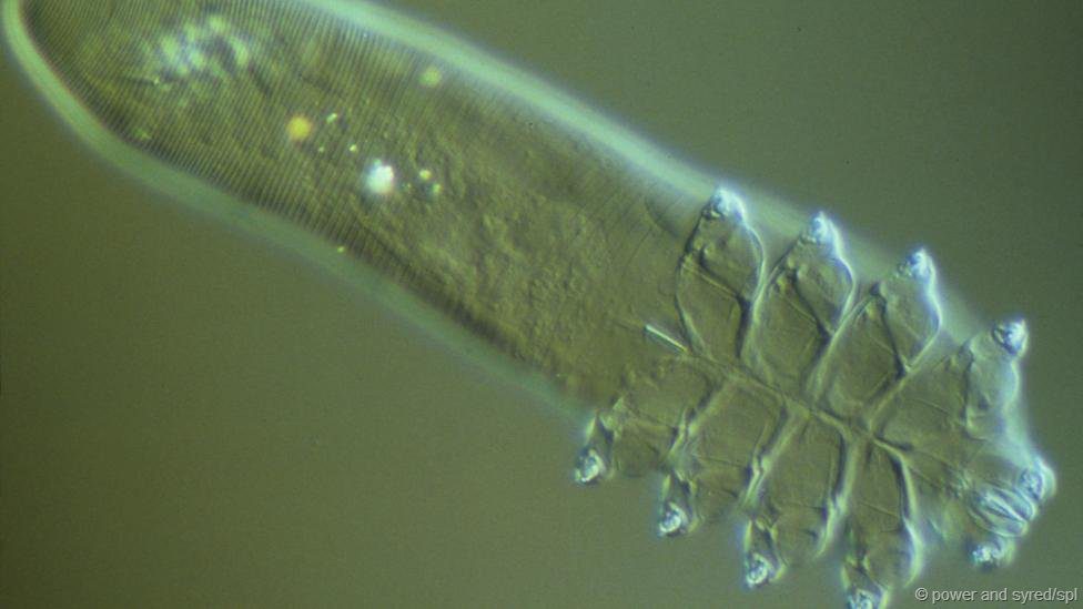 Demodex - The Mite that Parasites on... Human Skin