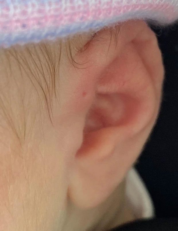 Having a small hole on the ear