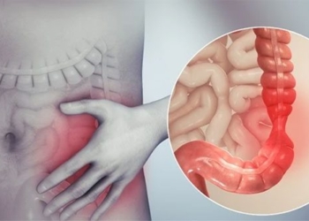 signs of recognizing appendicitis 136773