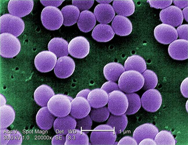Staphylococcus aureus under an electron microscope at 20,000x magnification.