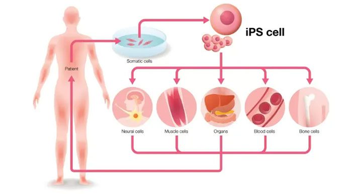 A diagram showing induced pluripotent stem cells (iPSCs)