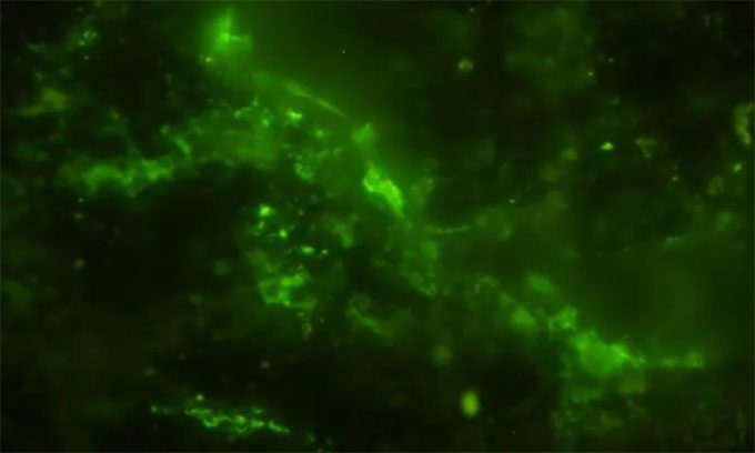 Microbial cells in the cracks of the 2 billion-year-old rock sample stained blue