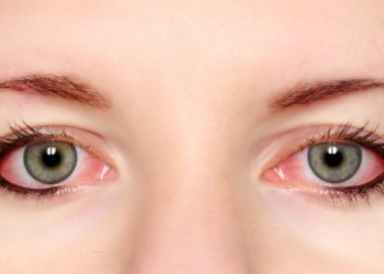 things you should know about eye pain 49455