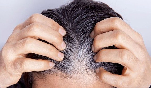 Gray hair reflects a fundamental change in the functioning of cells within the body.