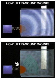 ultrasound 1